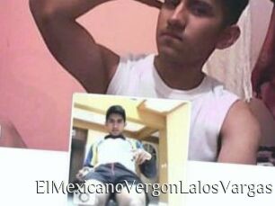 ElMexicanoVergonLalosVargas